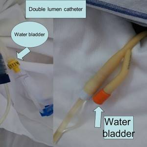 Medical Disposable Rectal Tube ConnectorAnal Cannal Catheter Connector