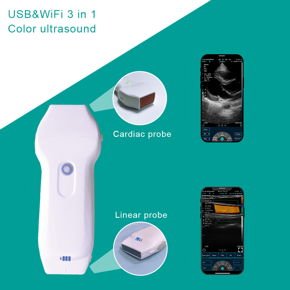Clinical Applications of Ultrasound Colour Doppler