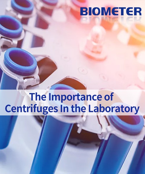 The importance of centrifuges in the laboratory