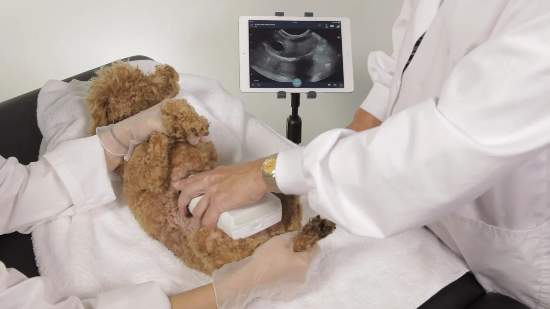 Apa Scan Ultrasound?