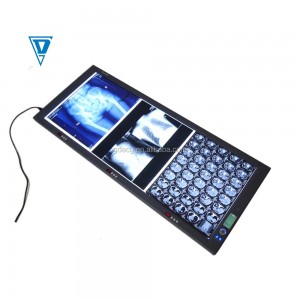LED Medical X-ray Film Viewer