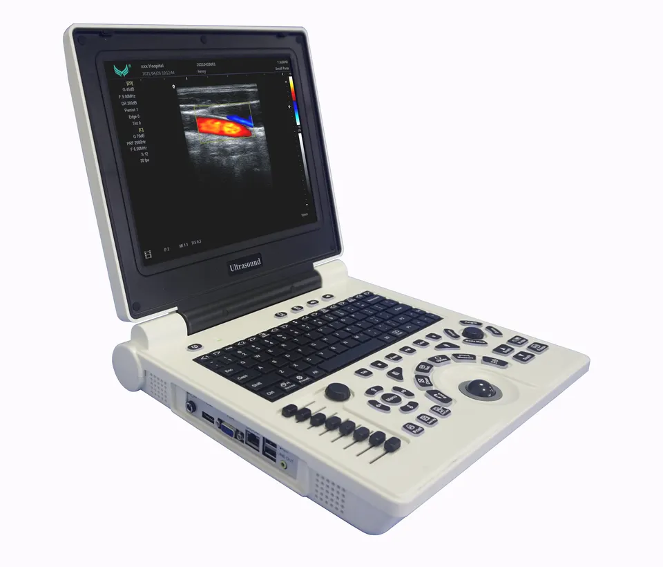 Alta calidad barato Xianfeng e20 escáner de ultrasonido portátil color doppler 3d máquina de ultrasonido y proveedor