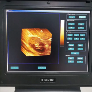 murang Xianfeng e20 ultrasound scanner portable color doppler 3d portable ultrasound machine