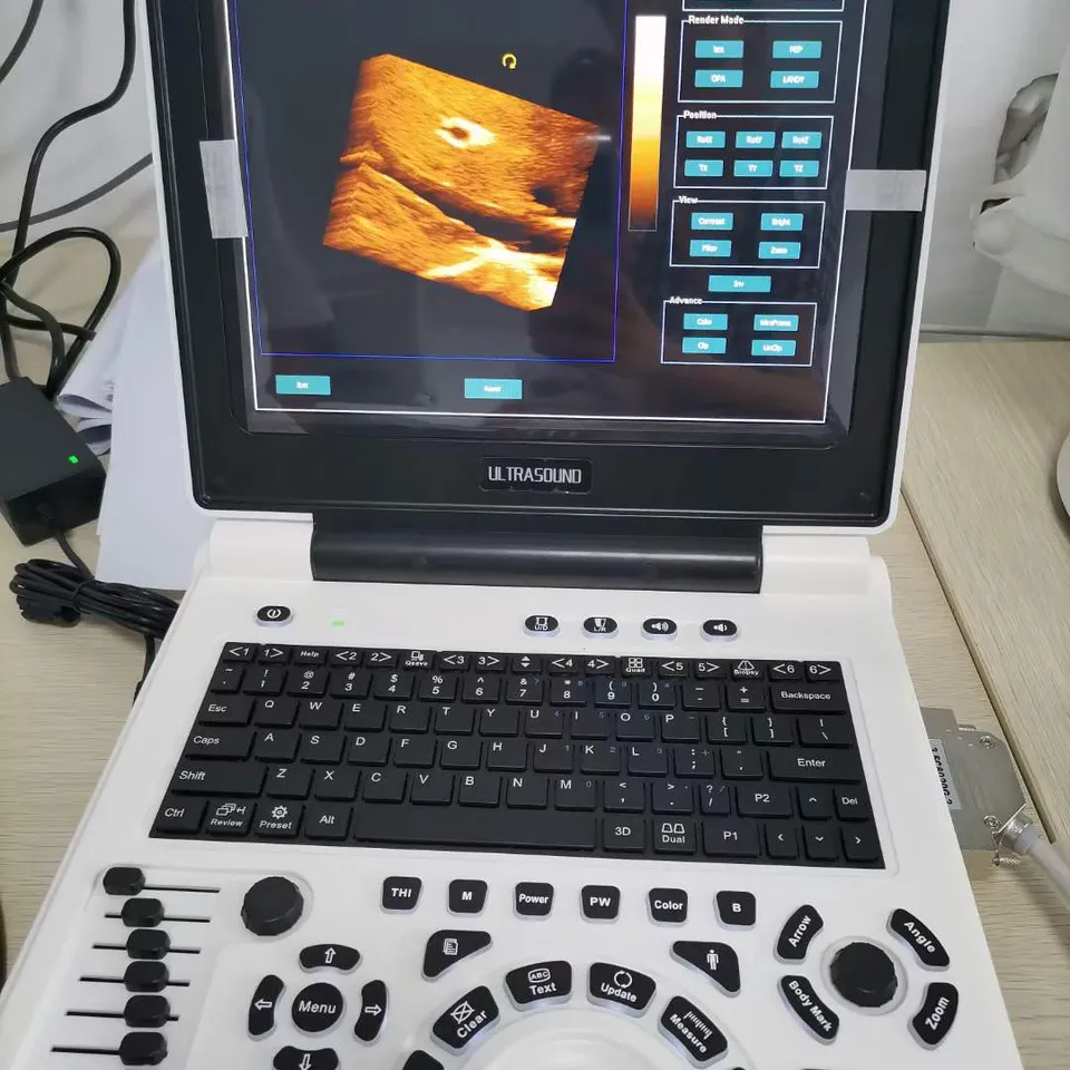 Alta calidad barato Xianfeng e20 escáner de ultrasonido portátil color doppler 3d máquina de ultrasonido y proveedor