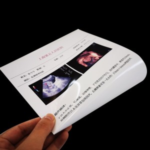 Ultrasound Dry PET White Inkjet laser Film Medical