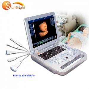 Special Design for Neck Ultrasound - 3D laptop ultrasound  for GYN, OB, Urology diagnostic – Sunbright