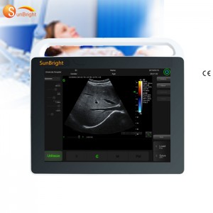 OEM/ODM Factory Brain Ultrasound - Laptop Ultrasound 15  inches Touch Screen Sun-800S – Sunbright