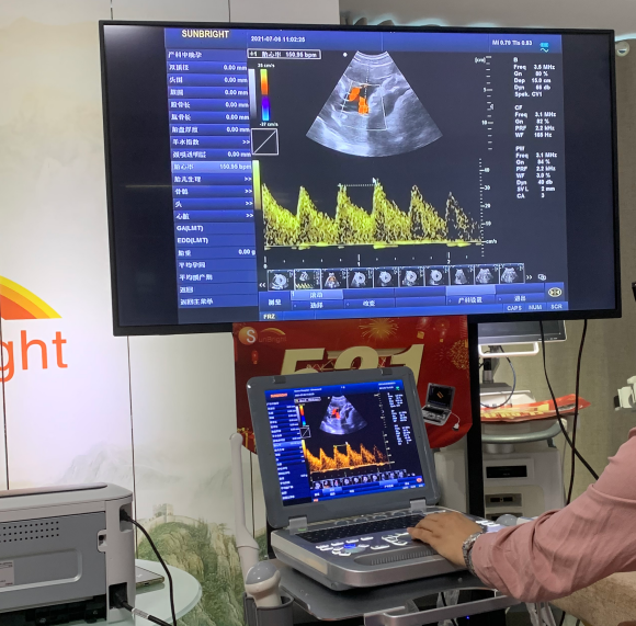 Why more and more doctors choose our Sunbright laptop color Doppler ultrasound SUN-906 series ?