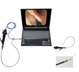 Cureus | Video-Assisted Thoracoscopic Surgery (VATS) for Spontaneous Pneumothorax and Emphysematous Bullous Lung Disease: A Study From Northern India