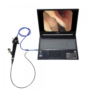 Cystoscope bhidio roghainneil USB so-ghiùlain - Endoscope sùbailte