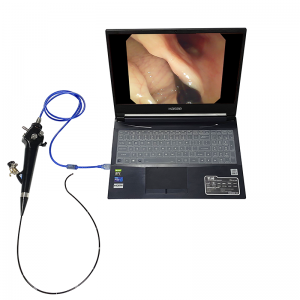 Top 1 hotsale HD resolusi video pilihan USB mudah alih ureteroscope-Flexible Endoskop