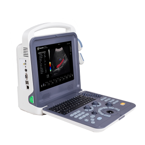 Ultrasound Doppler ສີແບບພົກພາ (K2)