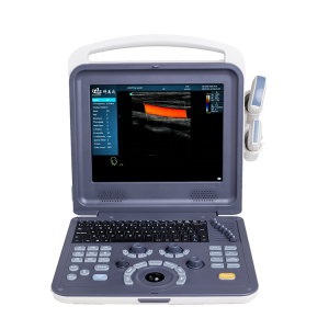 အိတ်ဆောင်အရောင် Doppler Ultrasound (K0)