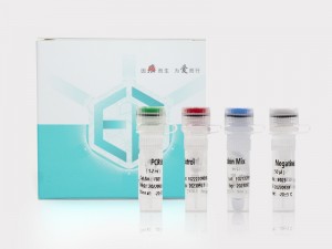 TAGMe DNA Methylation Detection Kits (qPCR) vir Urotheelkanker