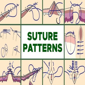 Common Suture Patterns（2）