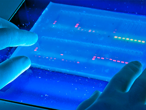 د DNA الکتروفوریسس عام مسلې