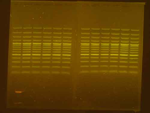Praestare DNA Electrophoresis in Agarose gel