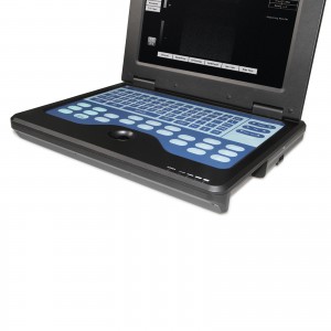 Ultrasound scanner portable ultrasound machine,Ultrasound Monitor manufacturers