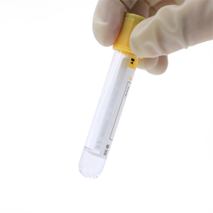 Ống kích hoạt gel & cục máu đông HBH để kiểm tra sinh hóa