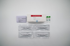 PIV1 Nucleic Acid Test Kit (PCR-fluorescence probe method)