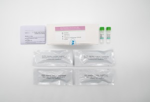 EV Комплект за тестване на нуклеинова киселина (PCR-метод на флуоресцентна сонда)
