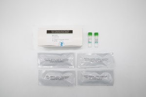 EV71 ನ್ಯೂಕ್ಲಿಯಿಕ್ ಆಸಿಡ್ ಟೆಸ್ಟ್ ಕಿಟ್ (PCR- ಫ್ಲೋರೊಸೆನ್ಸ್ ಪ್ರೋಬ್ ವಿಧಾನ)