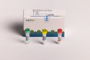 Ngwa 2019-nCoV Nucleic Acid Test Kit (usoro nyocha nke fluorescence PCR)