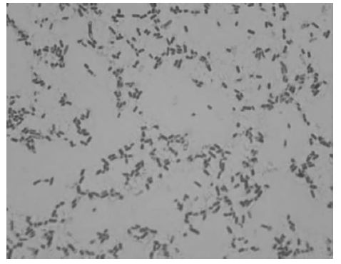Batteri patogeni comuni di origine alimentare: Salmonella
