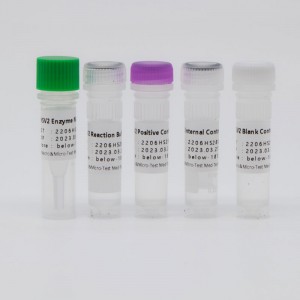 Herpes Simplex Virus Typ 2 Nukleinsäure Detektioun Kit (Isothermesch Amplifikatioun)