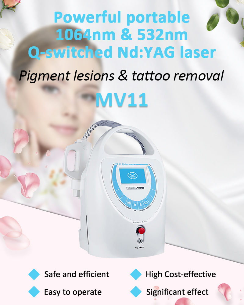 MV11 Portable Q-Switched Nd:YAG Laser Pigment Lesions & Tattoo Removal Beauty Salon Machine