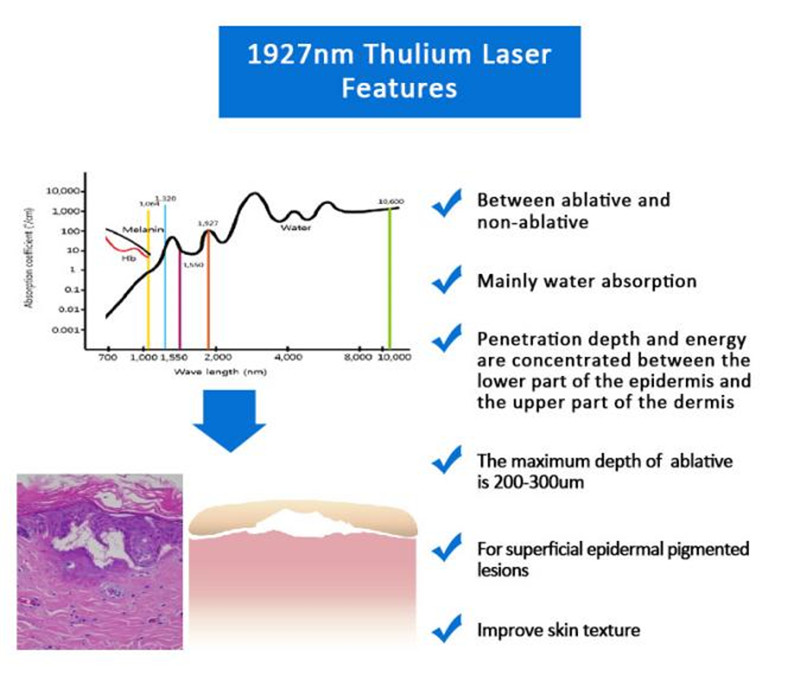 Laser Thulium Fractional 1927KK 1927nm (6)