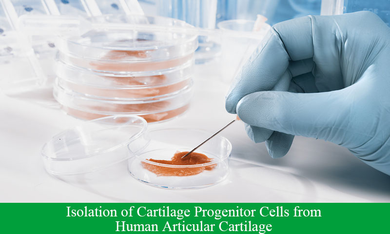 Isolation of Cartilage Progenitor Cells from Human Articular Cartilage