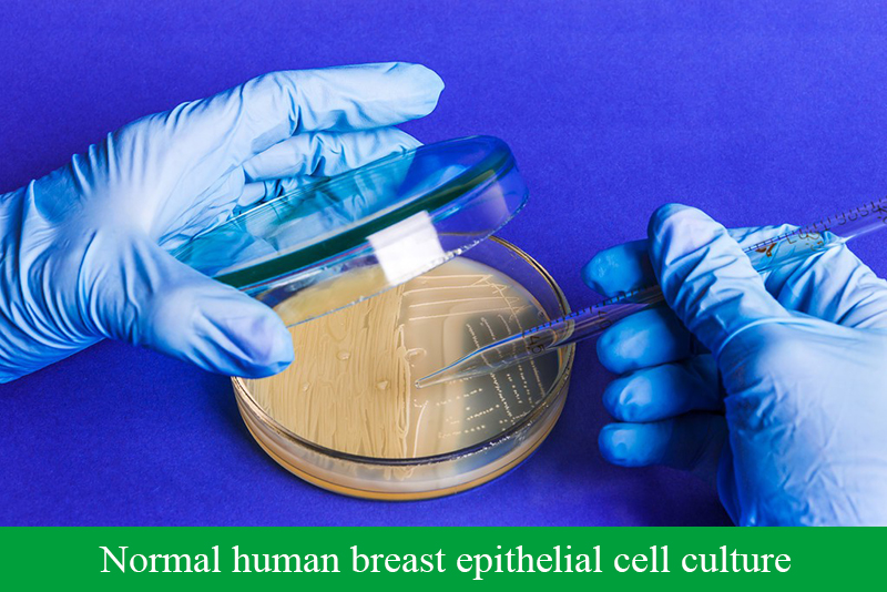 Normal human breast epithelial cell culture
