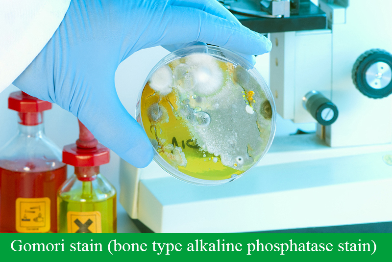 Gomori stain (bone type alkaline phosphatase stain)