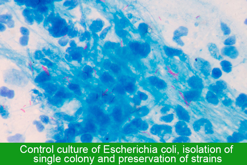 Control culture of Escherichia coli, isolation of single colony and preservation of strains