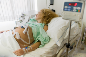 Koji je parametar fetalnog otkucaja srca u fetalnom monitoru?