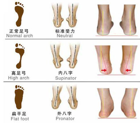 Máis información sobre Flat Feet