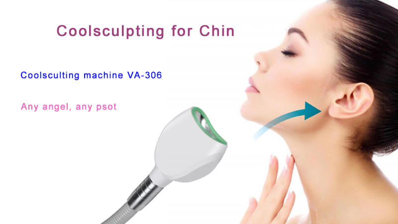 Coolsculpting Chin double chin treatment