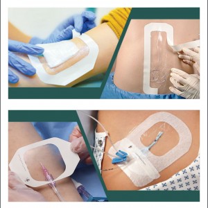 Venous Transfusion Products IV cannula dressing