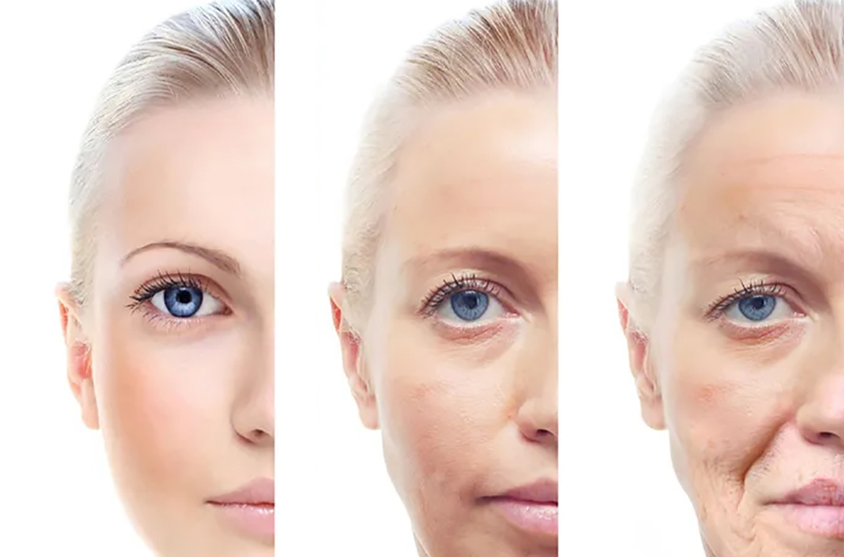 DPL Precision skin rejuvenation – the best solution for skin photoaging