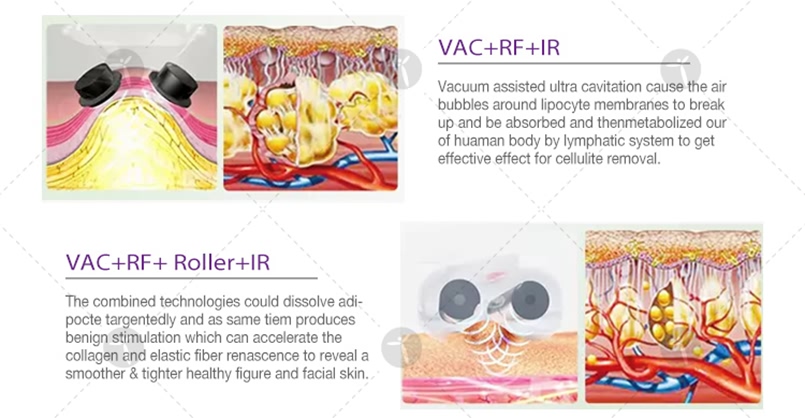 Hot sale slimming machine Vacuum Rollers RF cavitation velashape (1 (8)