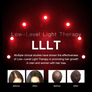 Lāzera matu augšanas sistēma Red Light Therapy matu augšanas vāciņš