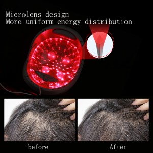 Система росту волосся LESCOLTON, дозволено FDA – лазер медичного класу 56