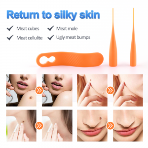 LS-D822 Skin Mole Wart Remover Kit With Cleansing Swabs Dewasa Mole Wart Face Care Skin Tag Removal
