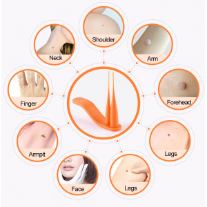 LS-D822 Haut-Maulwurf-Warzen-Entferner-Set mit Reinigungstupfern, Erwachsenen-Maulwurf-Warzen-Gesichtspflege, Entfernung von Hautflecken