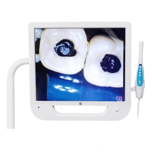 Câmera intra oral de vídeo Clínica Dentária Universidade usa vídeo VGA
