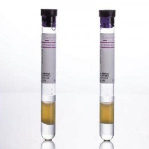 තනි Muclear Cell Gel Separation Tube—CPT Tube