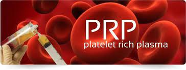US Platelet Rich Plasma Iwon, Pin & Awọn aṣa Iṣiro Iroyin