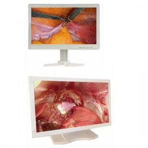 Pantalla de visualización do paciente con monitor médico led de 24 polgadas para cirurxía e exame