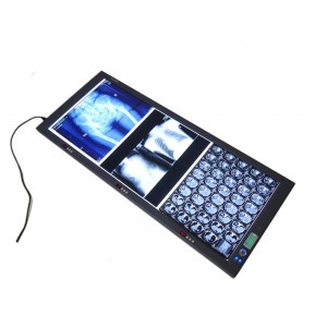 Triple bank x ray scanners film viewer led for medical films X ray illuminator x ray film viewer with CE factory